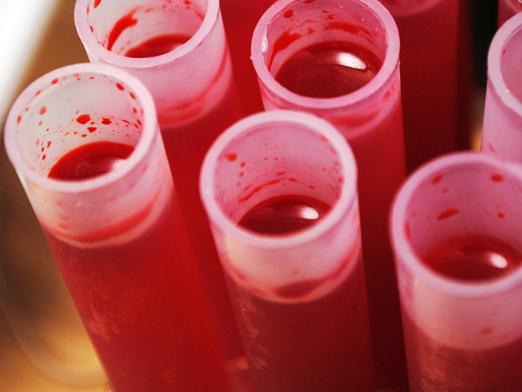 Ποιες είναι οι ομάδες αίματος;